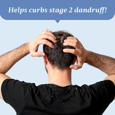Man Matters Anti Dandruff Shampoo 100ml & Removal Lotion 60ml | Removes Heavy Dandruff, Reduces Flakes & Relieves Scalp Irritation | Kit for Stage 2 Dandruff